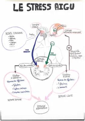le stress aigu