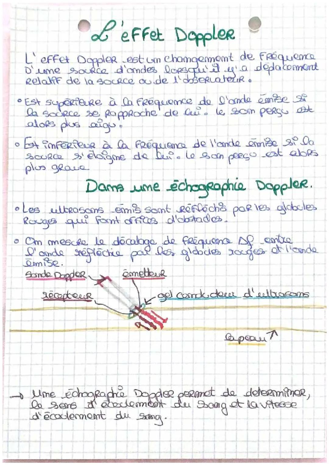 Découvre l'échographie Doppler et ses secrets amusants