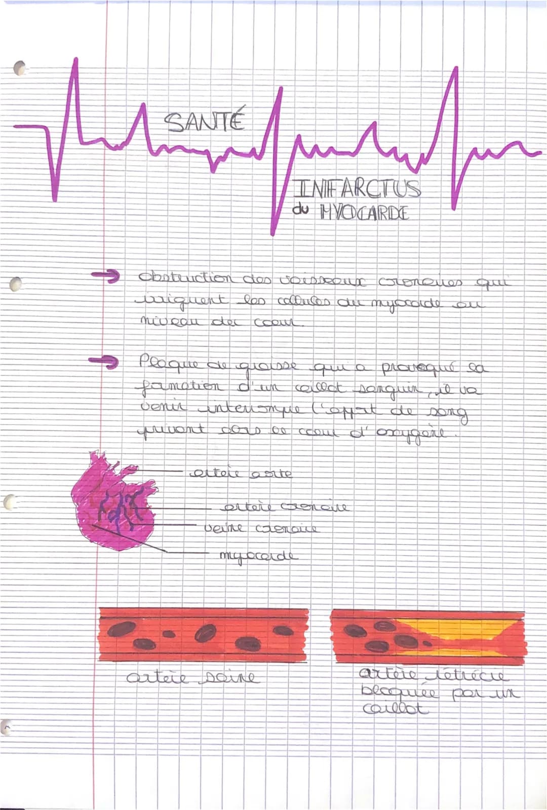 jhu
ساليسير الشتاليا
C
SANTÉ
ли
ettere arte
contruction des voisseur cronques qui
wriquent les colluces du myocarde ou
niveau dec coout
INFA