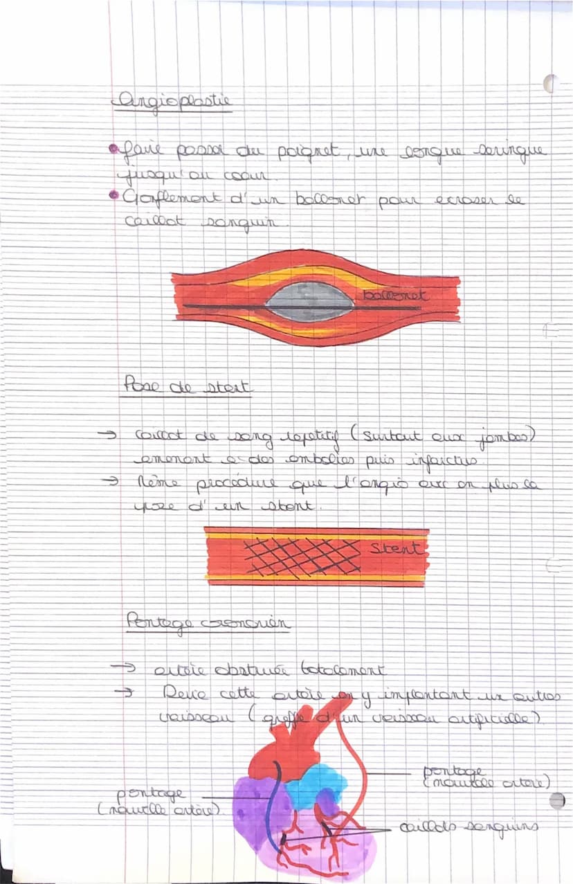 jhu
ساليسير الشتاليا
C
SANTÉ
ли
ettere arte
contruction des voisseur cronques qui
wriquent les colluces du myocarde ou
niveau dec coout
INFA