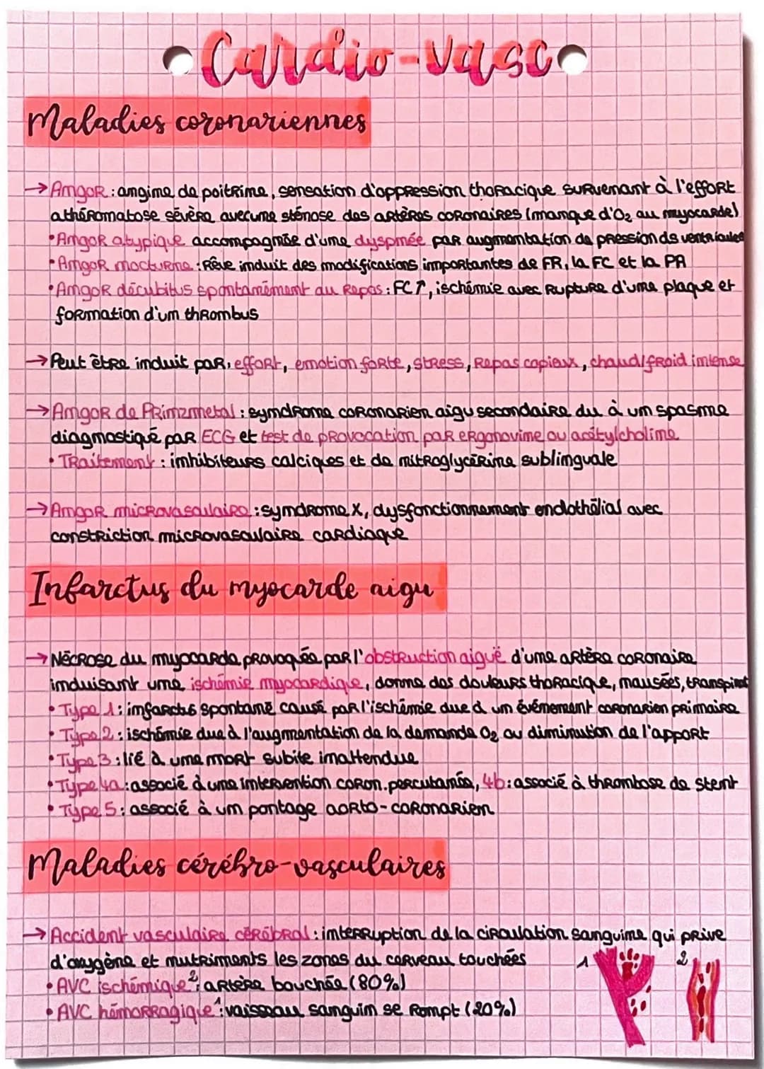 Cardio vasco
Maladies coronariennes
→AmgoR: angime de poitrime, sensation d'oppression thoracique survenant à l'effort
atheromatose sévère a