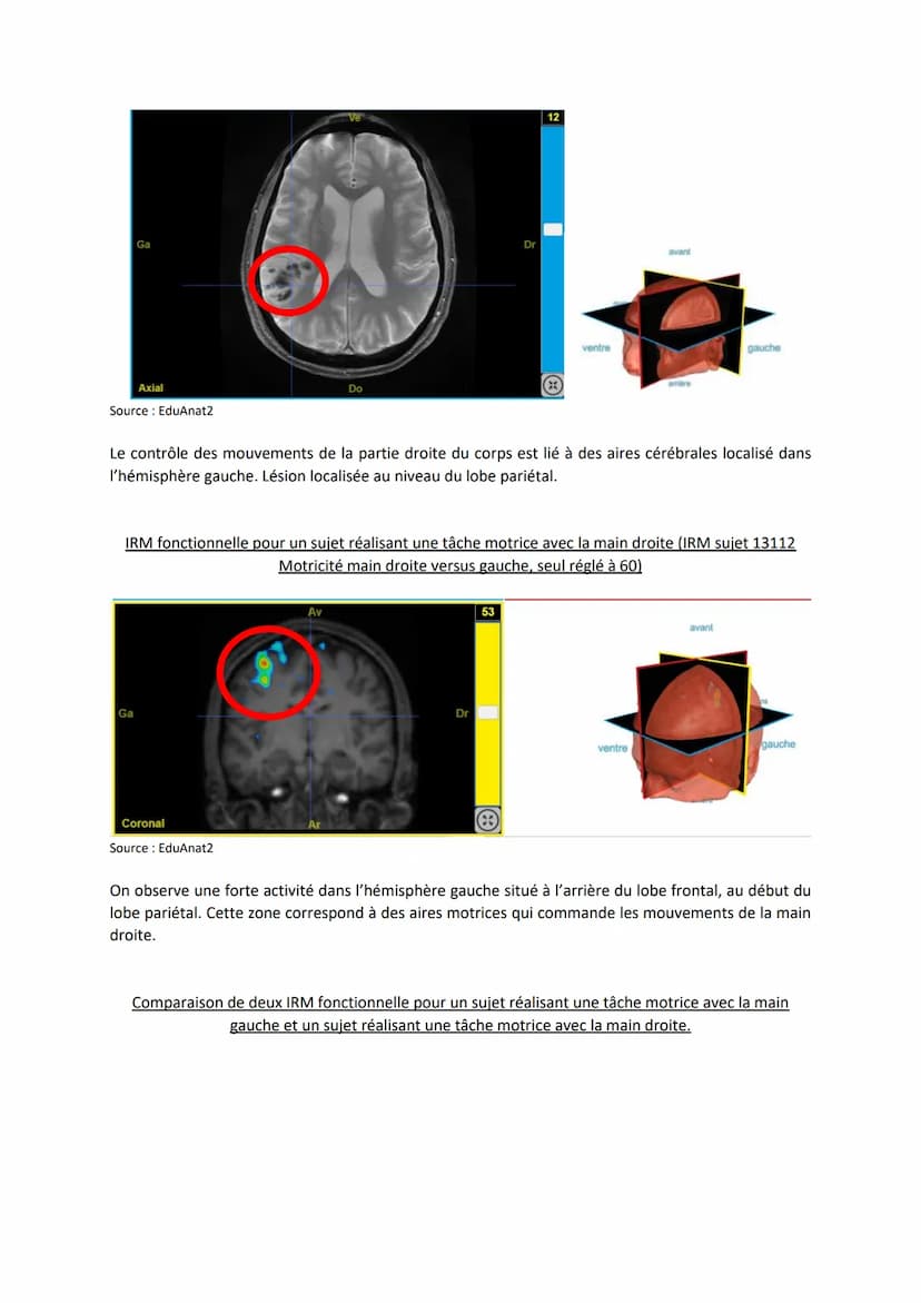 Chapitre 12
I.
Comment le cerveau intervient-il dans la commande de
mouvements volontaires ?
Introduction
LE CERVEAU
L'encéphale c'est le ce
