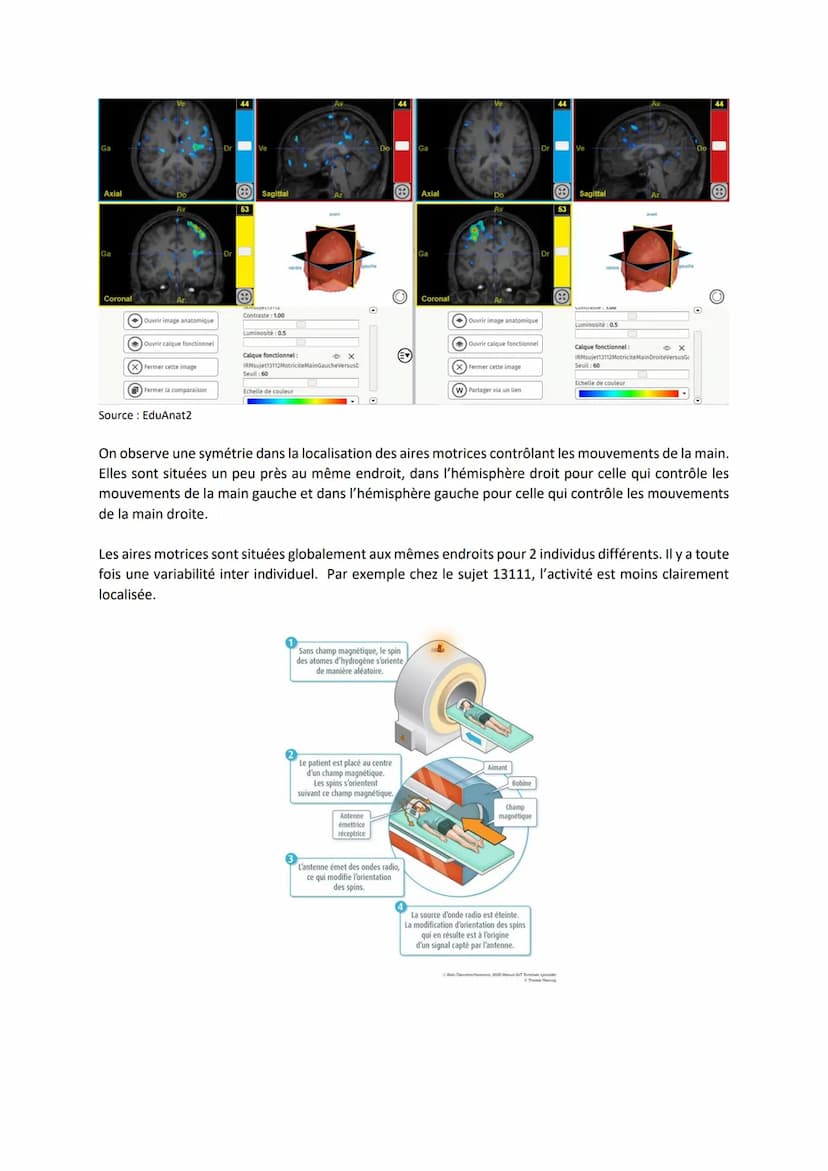 Chapitre 12
I.
Comment le cerveau intervient-il dans la commande de
mouvements volontaires ?
Introduction
LE CERVEAU
L'encéphale c'est le ce