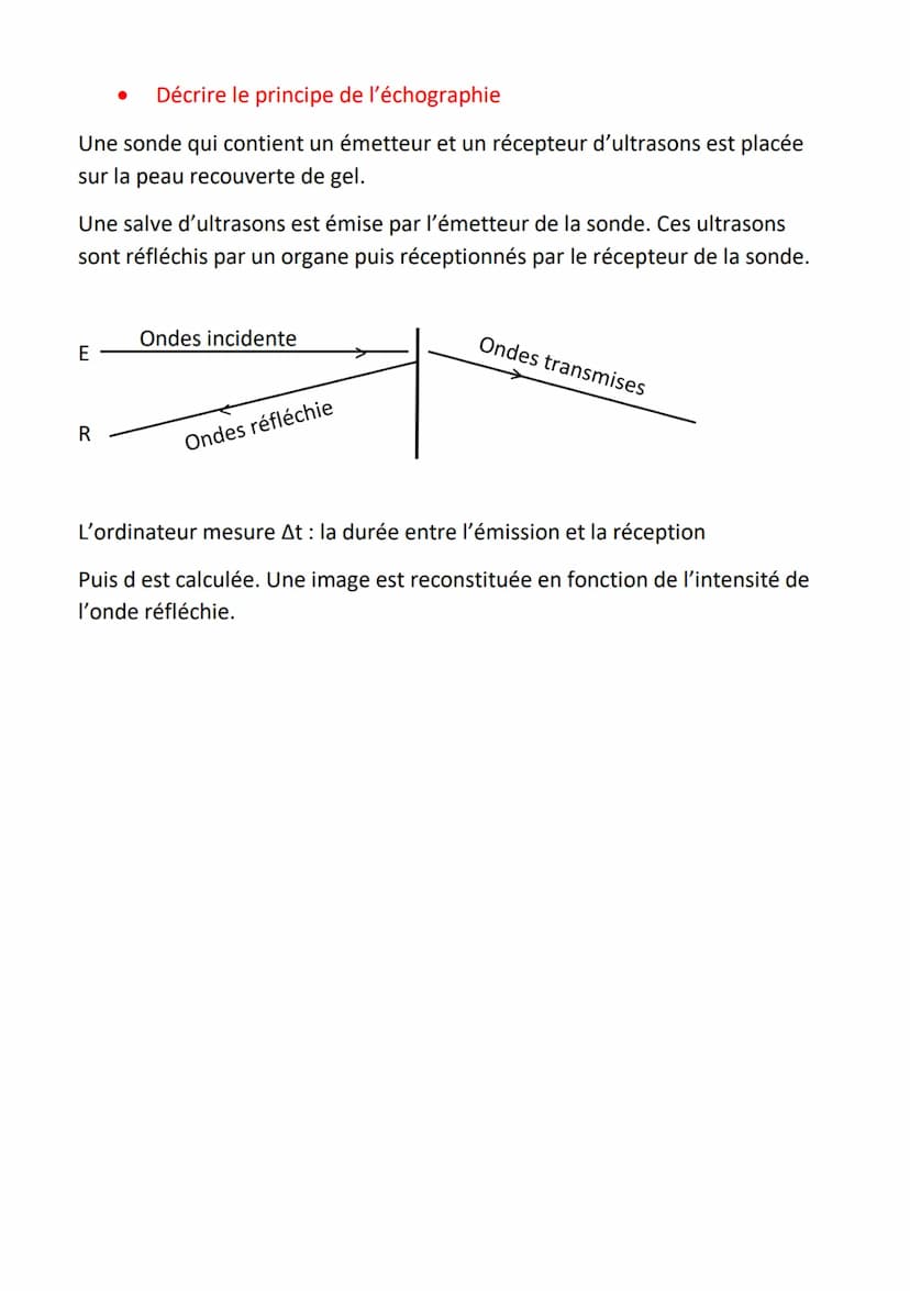 Quelle est la nature des ondes ultrasonores ?
Une onde ultrasonore fait partie des ondes sonores : ce sont des ondes
mécaniques; c'est-à-dir