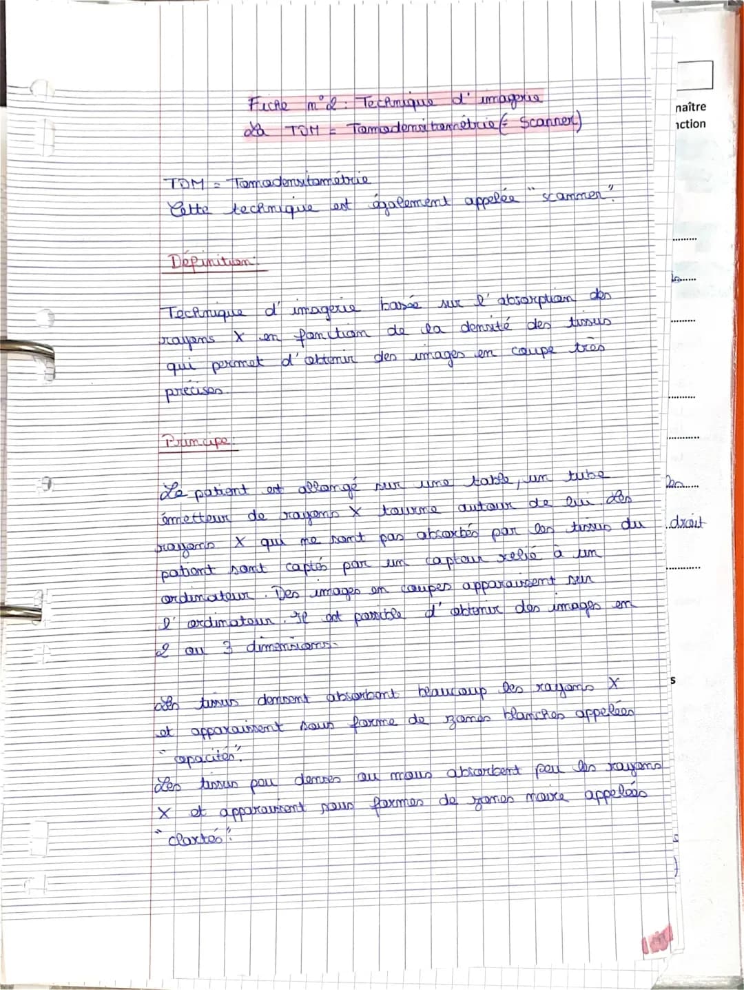 Scanner médical : C'est quoi ? Pourquoi faire un TDM ?