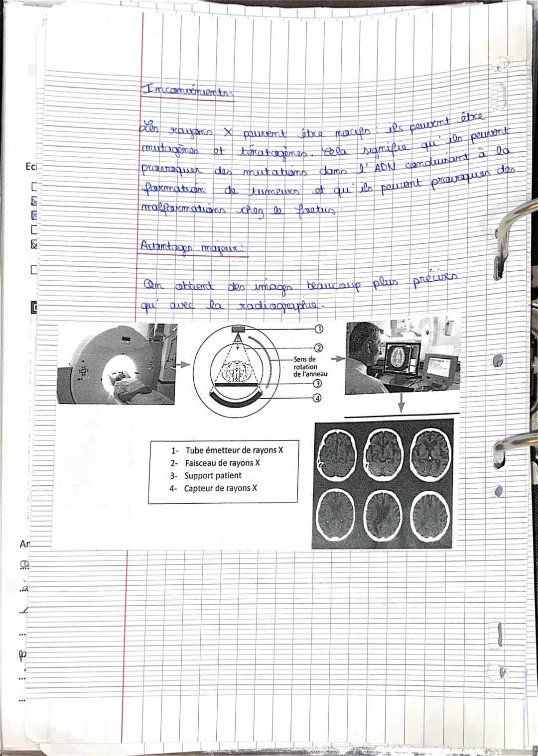 NW
9
Definition
Pramupe
-
TOM - Tomadensitometrie
Cette technique est également appelée scammer
Fiche mod
8 X
Technique d'imagerie
X
prayan'