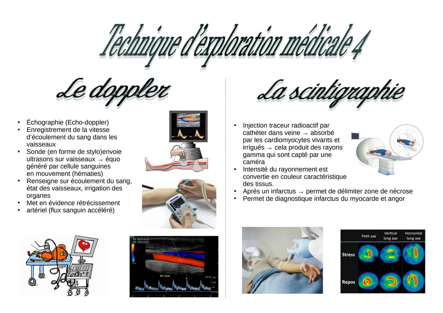 Technique d'exploration médicale 4
Le doppler
Échographie (Echo-doppler)
Enregistrement de la vitesse
d'écoulement du sang dans les
vaisseau