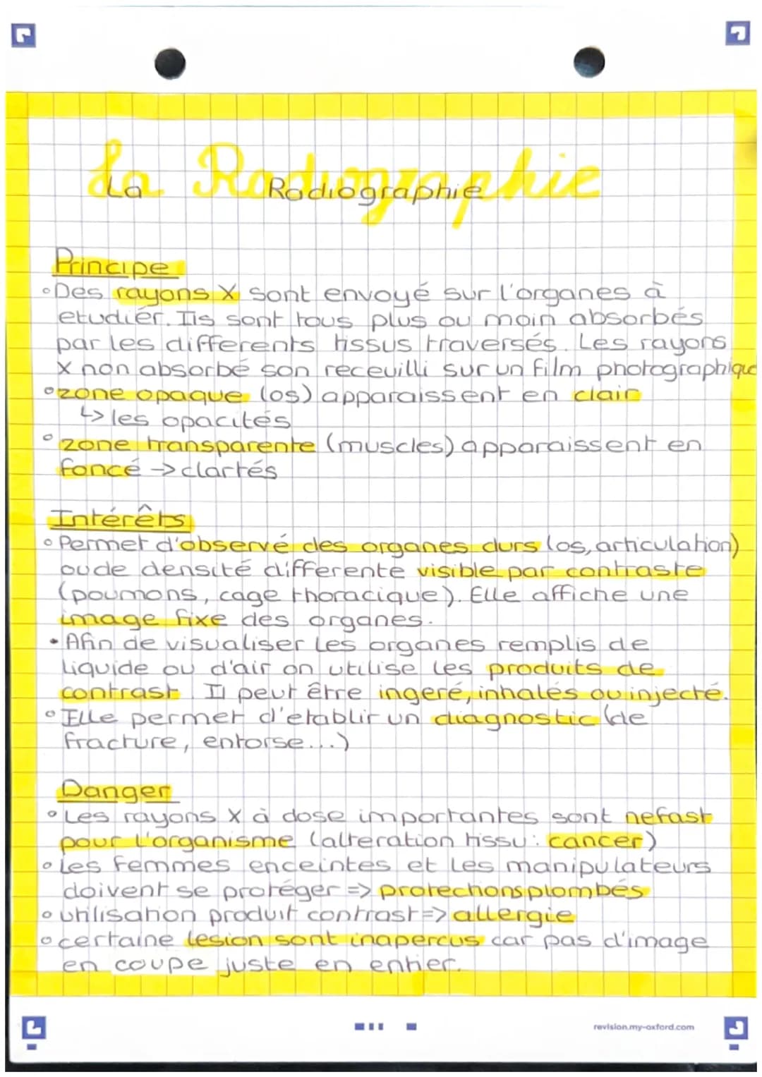 La R Radiographie die
Principe
•Des rayons X sont envoyé sur l'organes à
etudier. Ils sont tous plus ou moin absorbés
par les differents tis