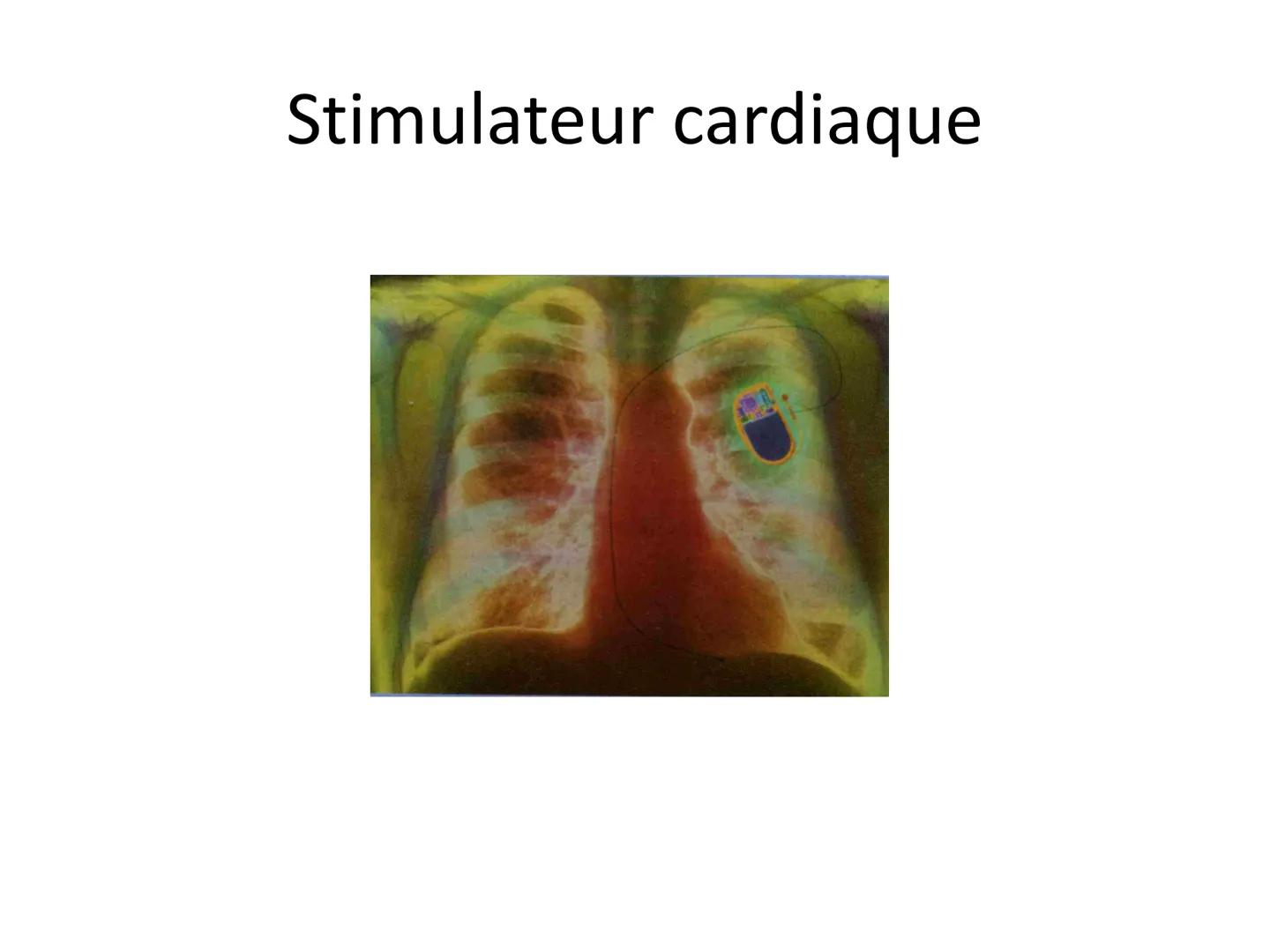 LE CŒUR ET LA CIRCULATION SANGUINE
CHAPITRE I: ORGANISATION GENERALE DU
SYSTEME CARDIO-VASCULAIRE
CHAPITRE II : FONCTIONNEMENT DU CŒUR.
CHAP