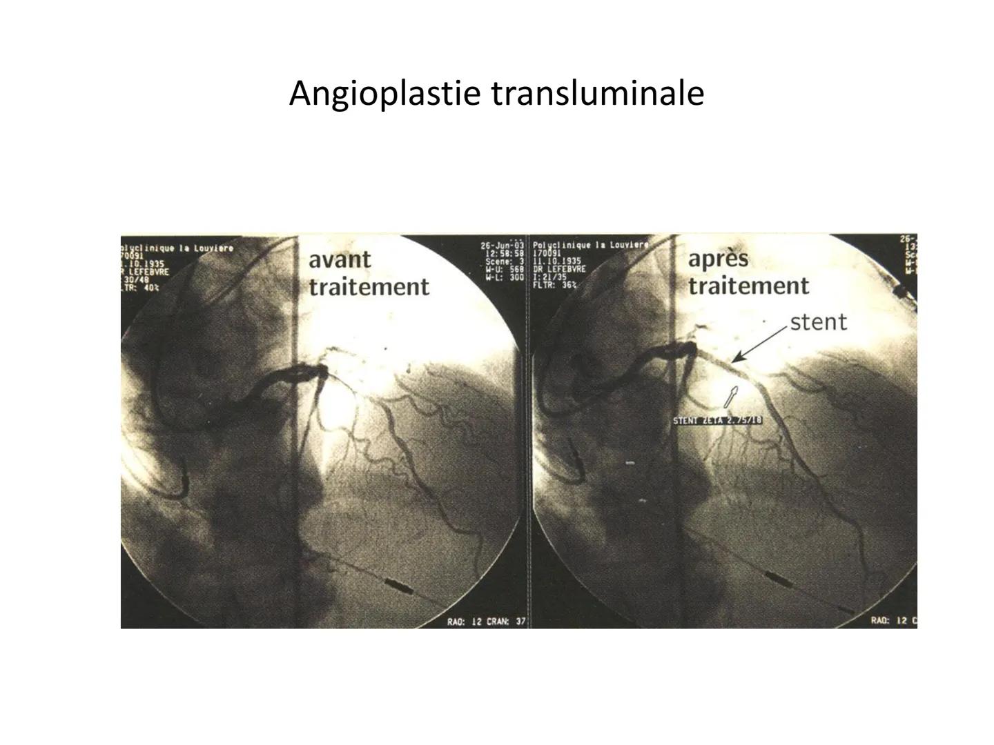 LE CŒUR ET LA CIRCULATION SANGUINE
CHAPITRE I: ORGANISATION GENERALE DU
SYSTEME CARDIO-VASCULAIRE
CHAPITRE II : FONCTIONNEMENT DU CŒUR.
CHAP