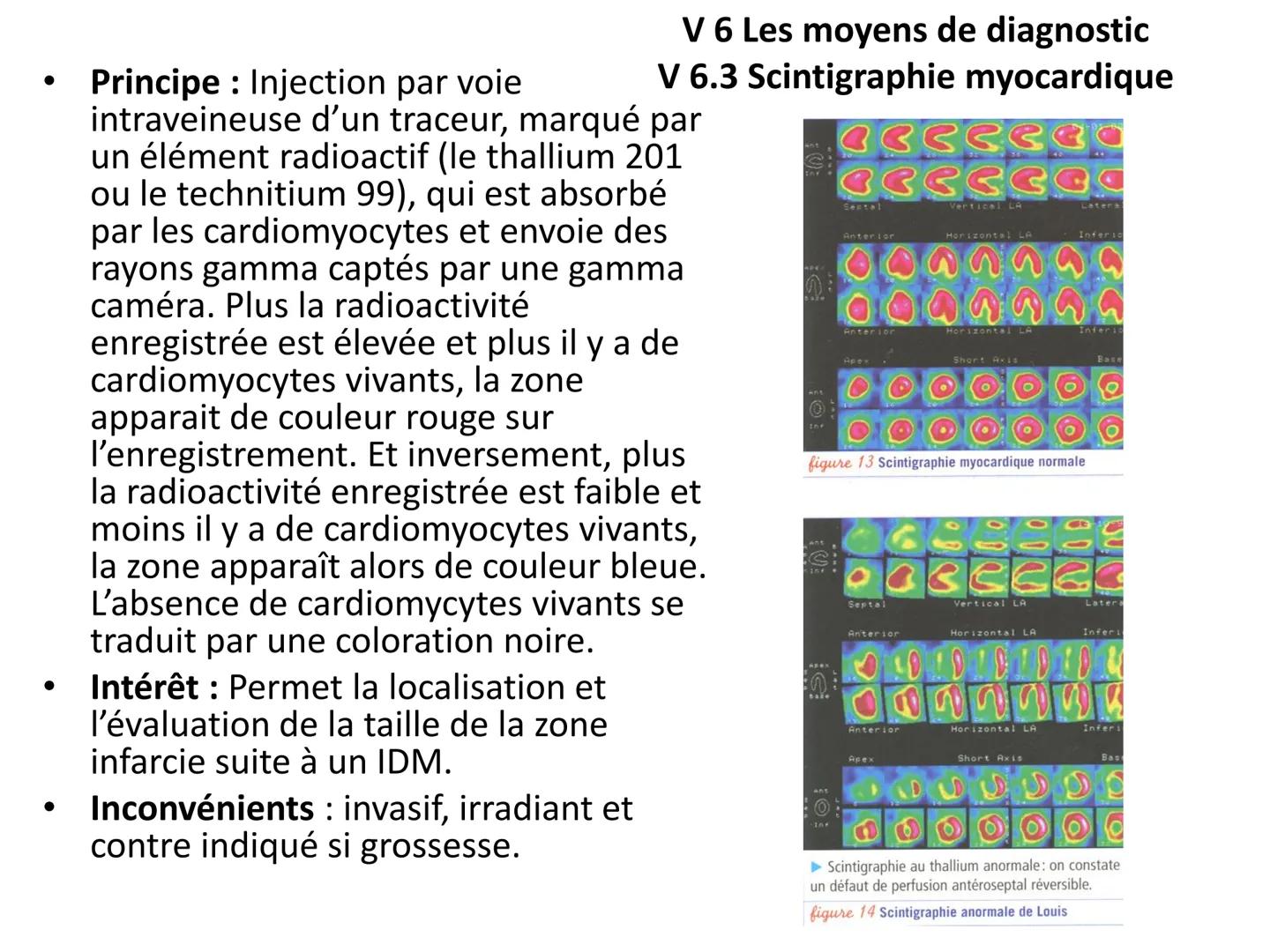 LE CŒUR ET LA CIRCULATION SANGUINE
CHAPITRE I: ORGANISATION GENERALE DU
SYSTEME CARDIO-VASCULAIRE
CHAPITRE II : FONCTIONNEMENT DU CŒUR.
CHAP