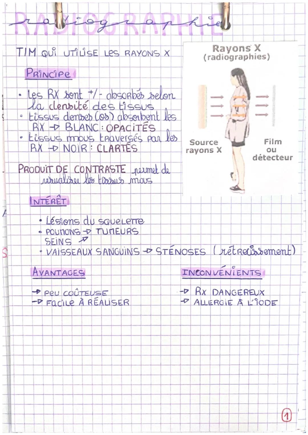 # rakiographie

TIM QUI UTILISE LES RAYONS X

PRINCIPE

*   Les RX sont +/- absorbés selon
    la densité des tissus
*   tissus denses (os) 