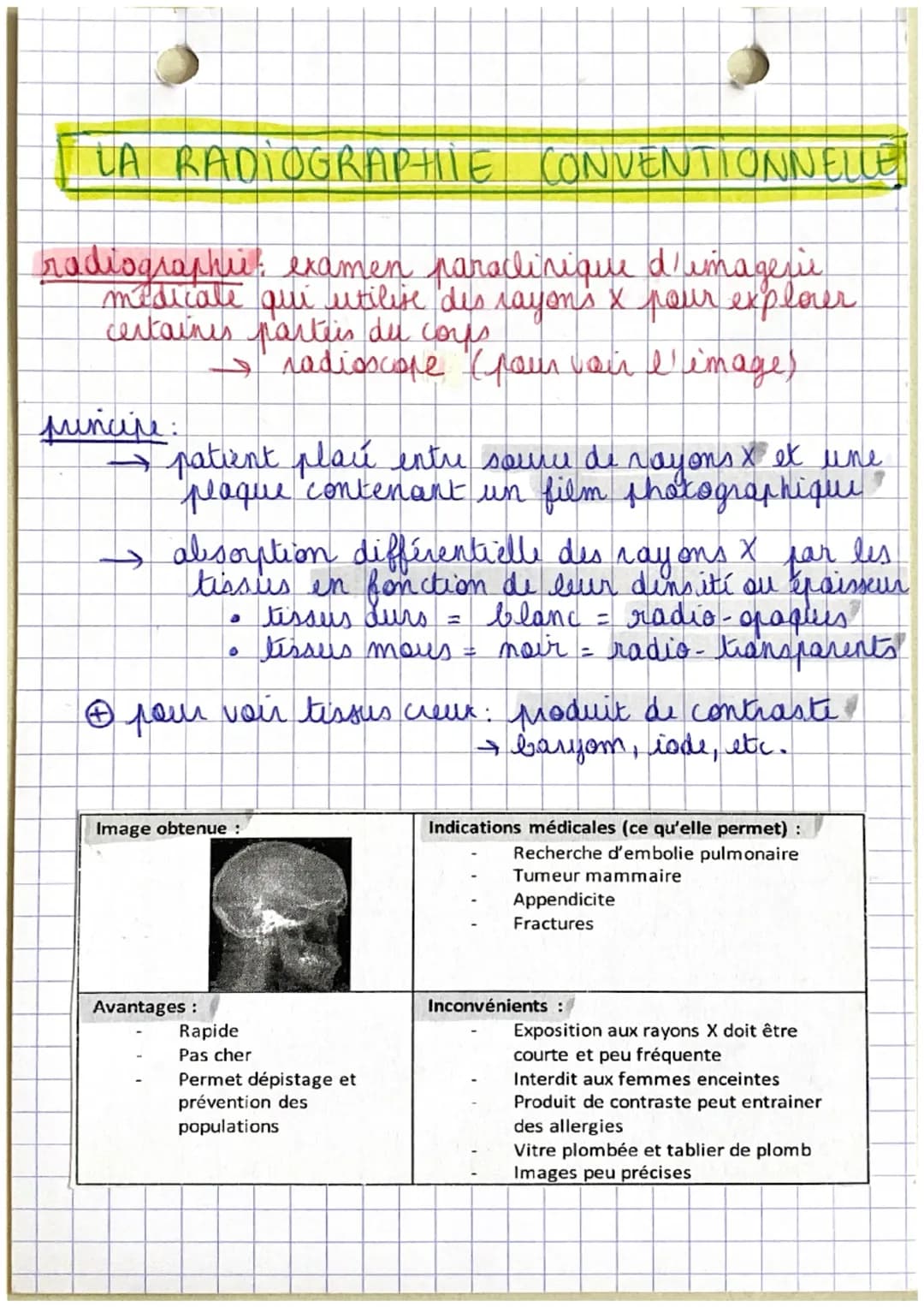 LA RADIOGRAPHIE CONVENTIONNELLE
radiographic examen paraclinique d'imagerie
medicale qui utilise des rayons x pour explorer.
certaines parte
