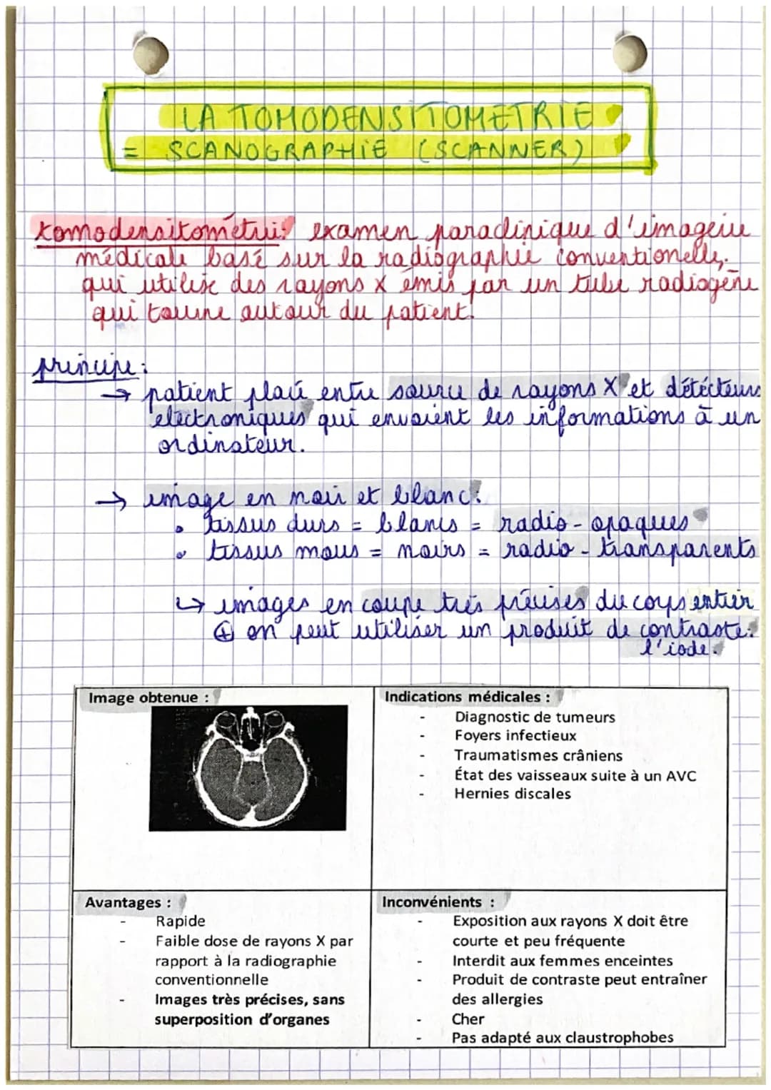 LA RADIOGRAPHIE CONVENTIONNELLE
radiographic examen paraclinique d'imagerie
medicale qui utilise des rayons x pour explorer.
certaines parte