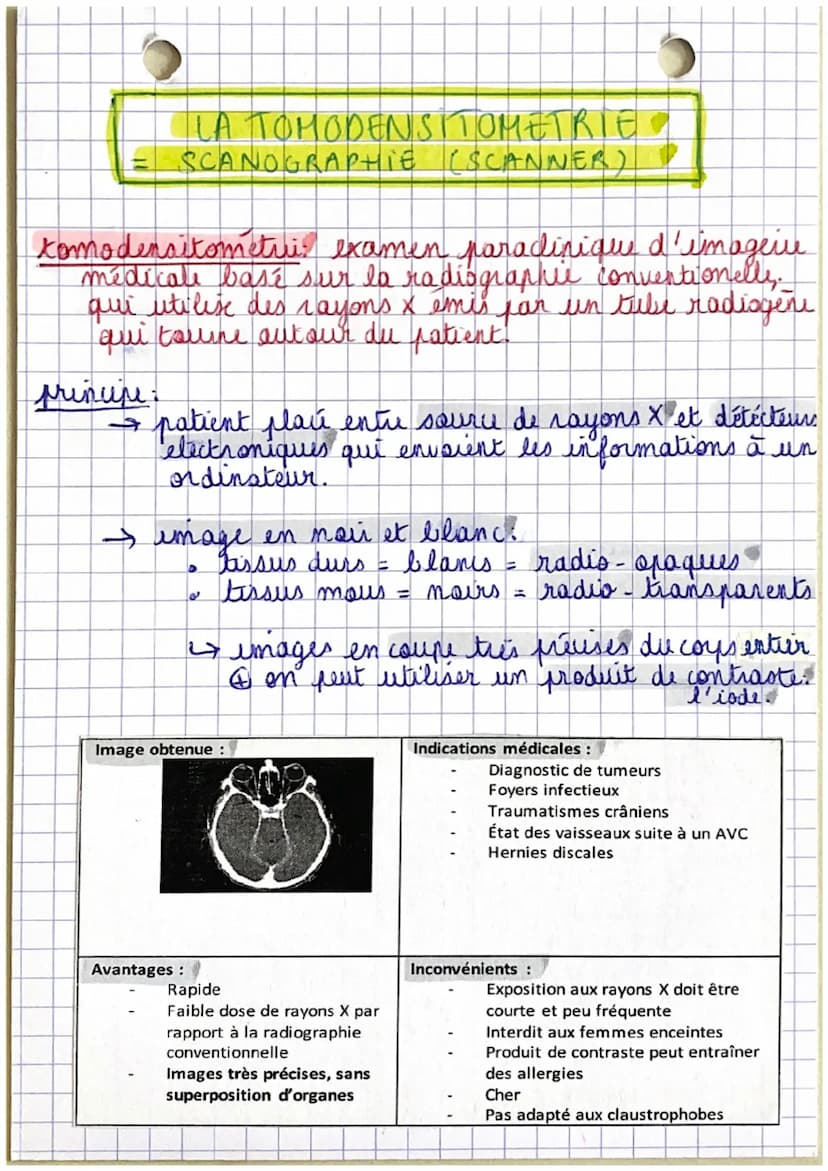 LA RADIOGRAPHIE CONVENTIONNELLE
radiographic examen paraclinique d'imagerie
medicale qui utilise des rayons x pour explorer.
certaines parte