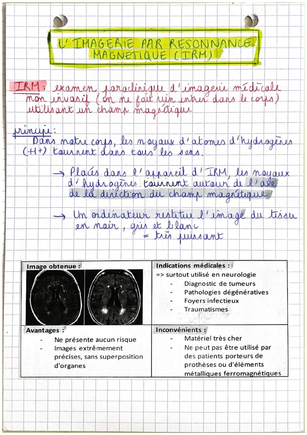 LA RADIOGRAPHIE CONVENTIONNELLE
radiographic examen paraclinique d'imagerie
medicale qui utilise des rayons x pour explorer.
certaines parte