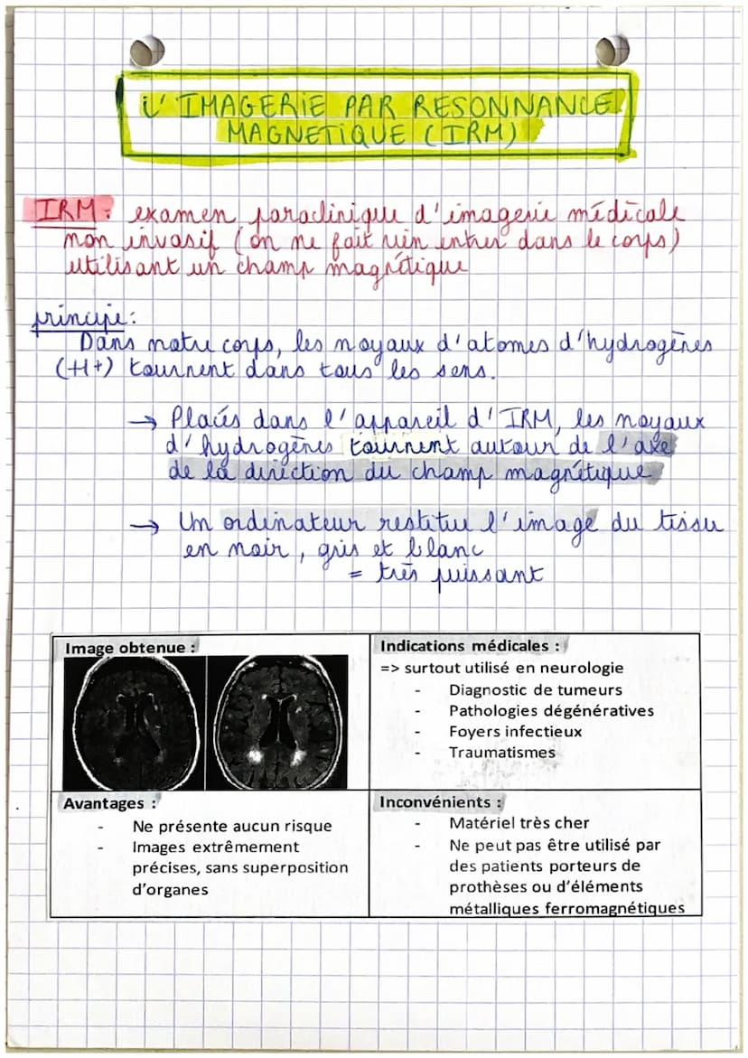 LA RADIOGRAPHIE CONVENTIONNELLE
radiographic examen paraclinique d'imagerie
medicale qui utilise des rayons x pour explorer.
certaines parte