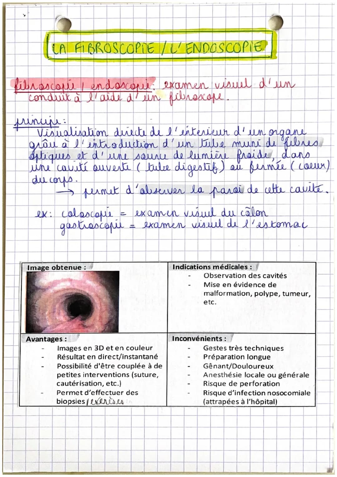 LA RADIOGRAPHIE CONVENTIONNELLE
radiographic examen paraclinique d'imagerie
medicale qui utilise des rayons x pour explorer.
certaines parte