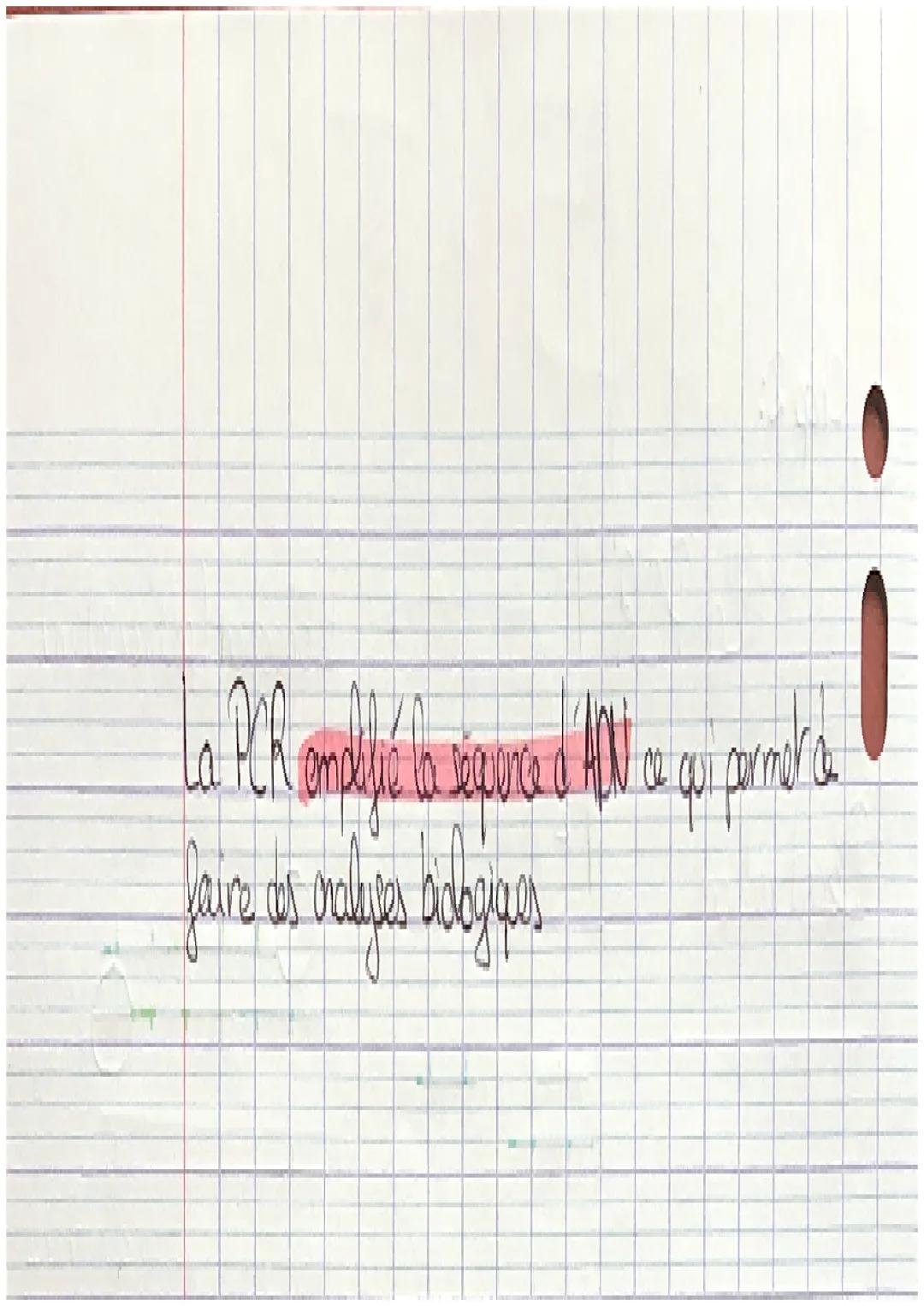 Chop 2:
La PCR
Denaturation
séparation
température
4
SVT
Hybridalion
I
+
fixations des amorces
Elongation (polimérisation)
OZADN
24
palymüre