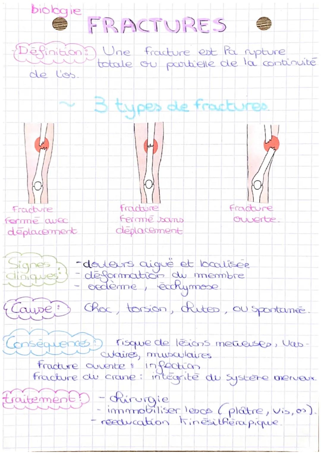 biologie
# FRACTURES
(Definition:) Une fracture est Pa rupture
totale ou partielle de la continuité
de l'os.

~ 3 types de fractures.

Fract