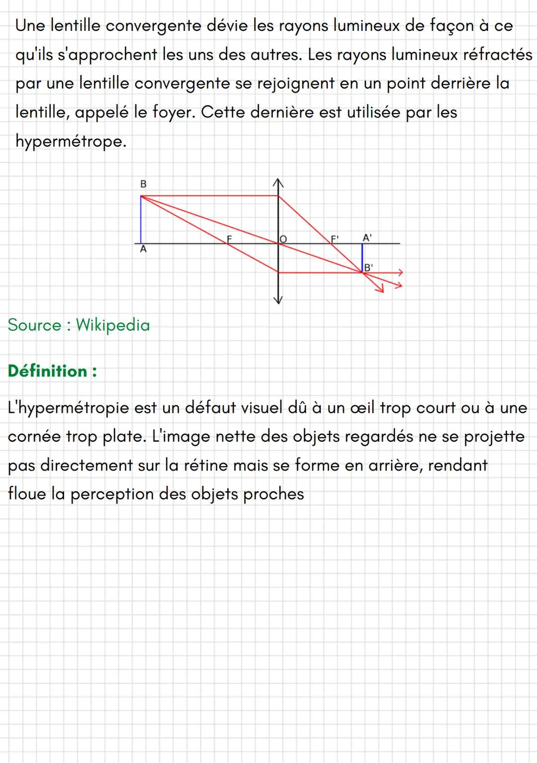 @mathisf_jsxc
Physique
Lentilles minces convergentes
muscles ciliaires
ligaments
cornée
iris
"||||
pupille
cristallin
chambre antérieure
(hu