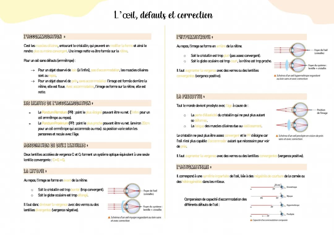 Comprendre l'accommodation de l'œil et la myopie
