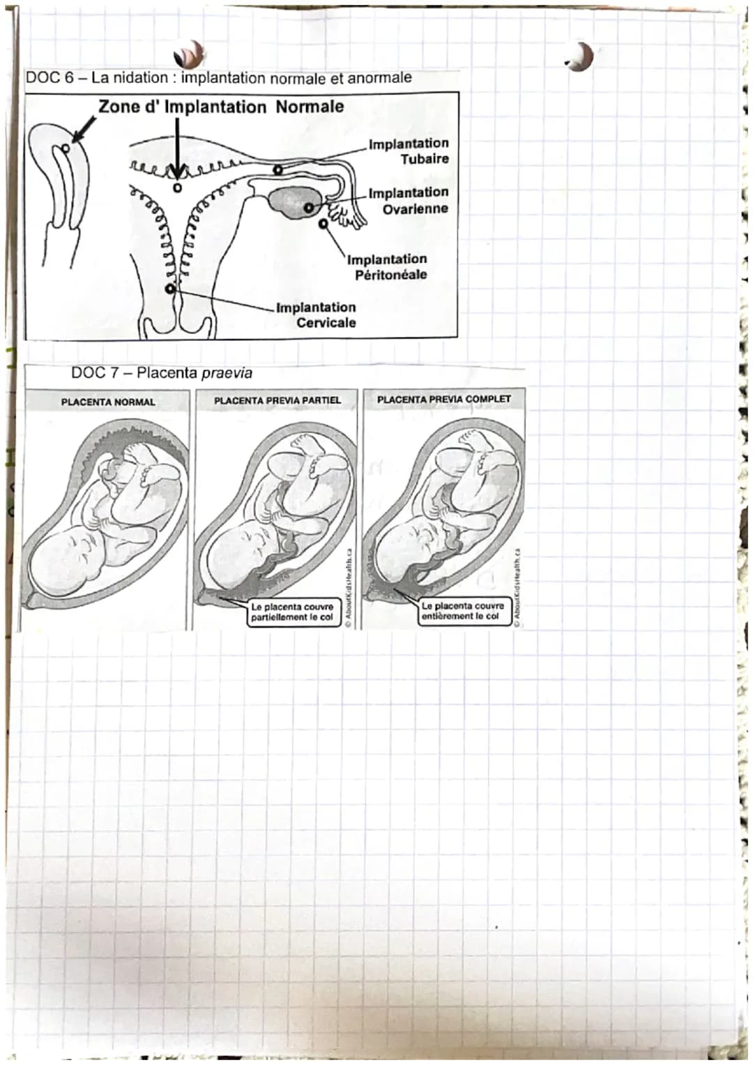 خرید
وبدا المنهم من الان
LA GROSBIESSE: PARTIE A
Fécondation : c'est la fusion d'un spermatozoide
et d'un ovocyte donnant une cellule
auf ap