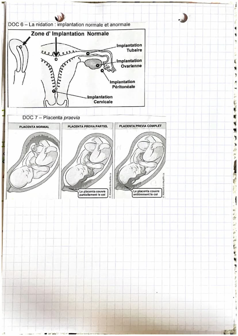 خرید
وبدا المنهم من الان
LA GROSBIESSE: PARTIE A
Fécondation : c'est la fusion d'un spermatozoide
et d'un ovocyte donnant une cellule
auf ap