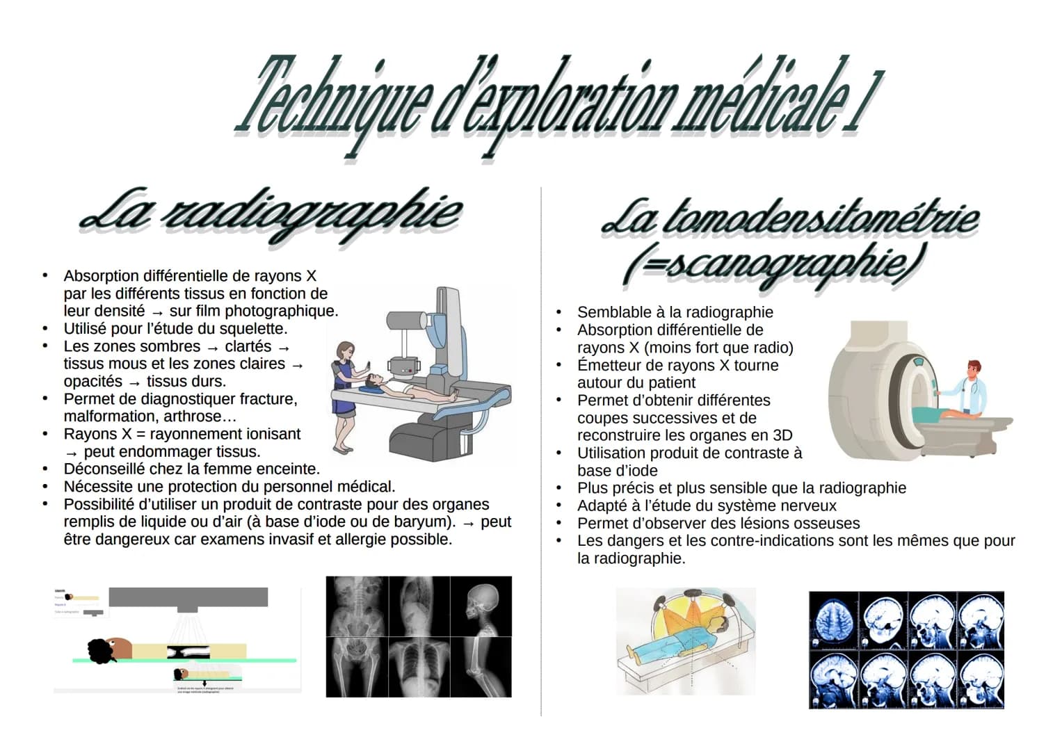 ●
●
Technique d'exploration médicale 1
La radiographie
Absorption différentielle de rayons X
par les différents tissus en fonction de
leur d