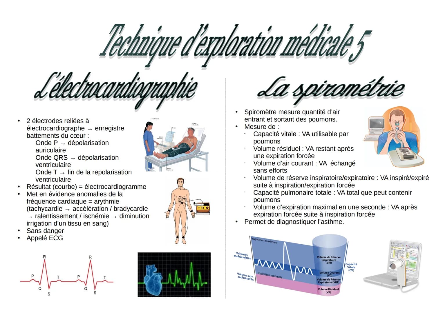 L'electrocardiographie
2 électrodes reliées à
électrocardiographe enregistre
battements du cœur :
Onde P
dépolarisation
auriculaire
Onde QRS