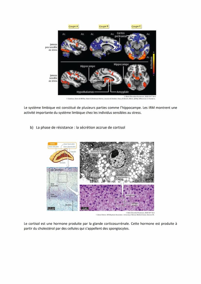 Chapitre 15
LE STRESS, UNE RÉPONSE
ADAPTATIVE
I. Le stress aigu, une réponse de l'organisme
Il y a une augmentation de la fréquence cardiaqu