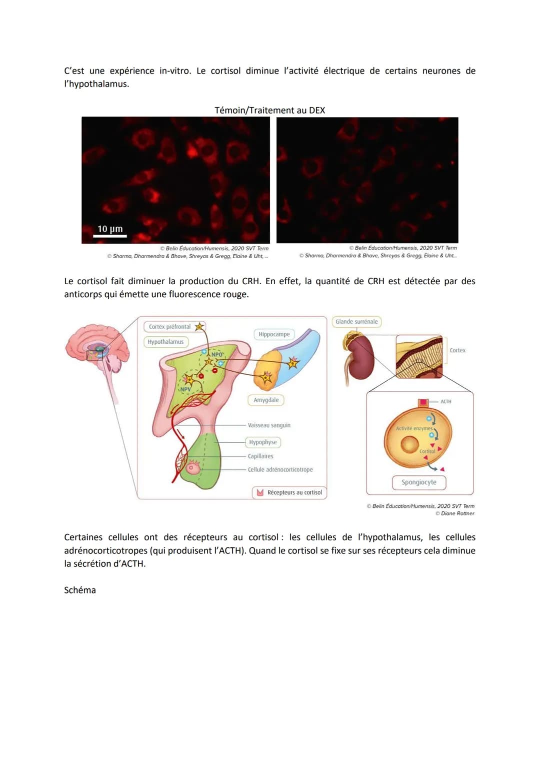 Chapitre 15
LE STRESS, UNE RÉPONSE
ADAPTATIVE
I. Le stress aigu, une réponse de l'organisme
Il y a une augmentation de la fréquence cardiaqu