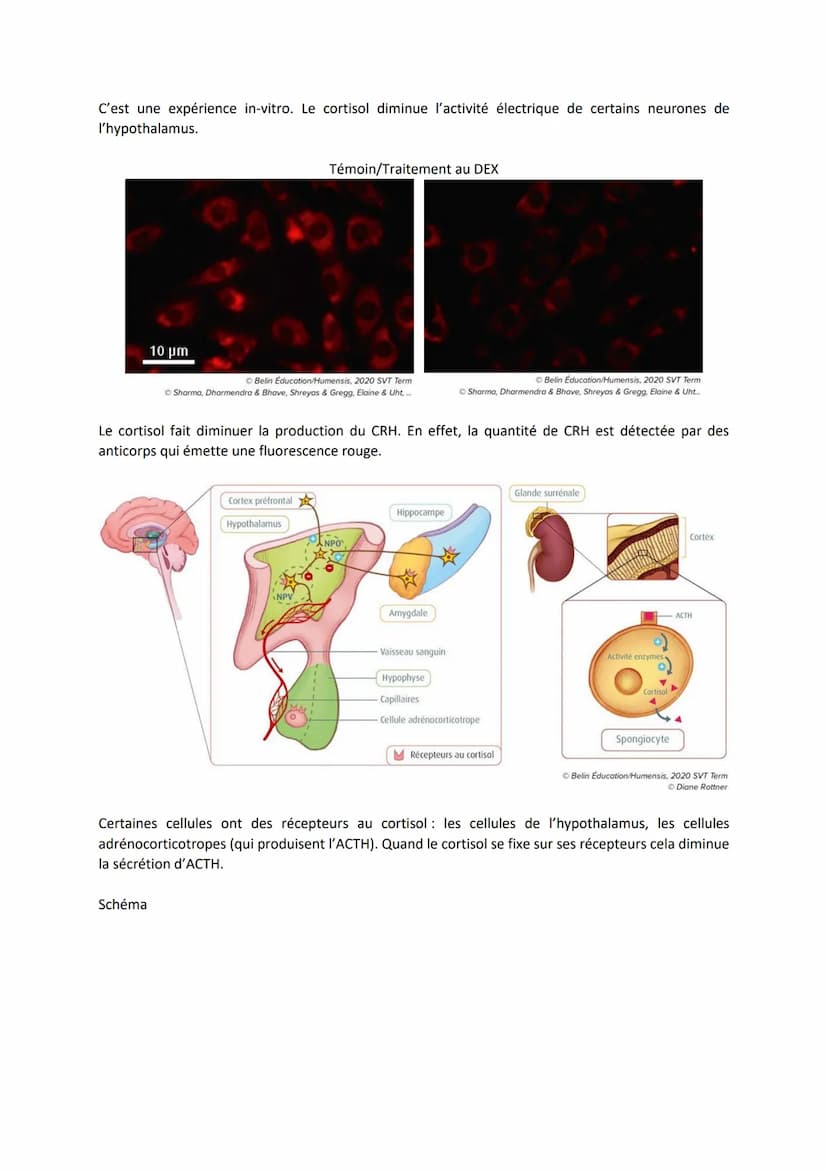 Chapitre 15
LE STRESS, UNE RÉPONSE
ADAPTATIVE
I. Le stress aigu, une réponse de l'organisme
Il y a une augmentation de la fréquence cardiaqu