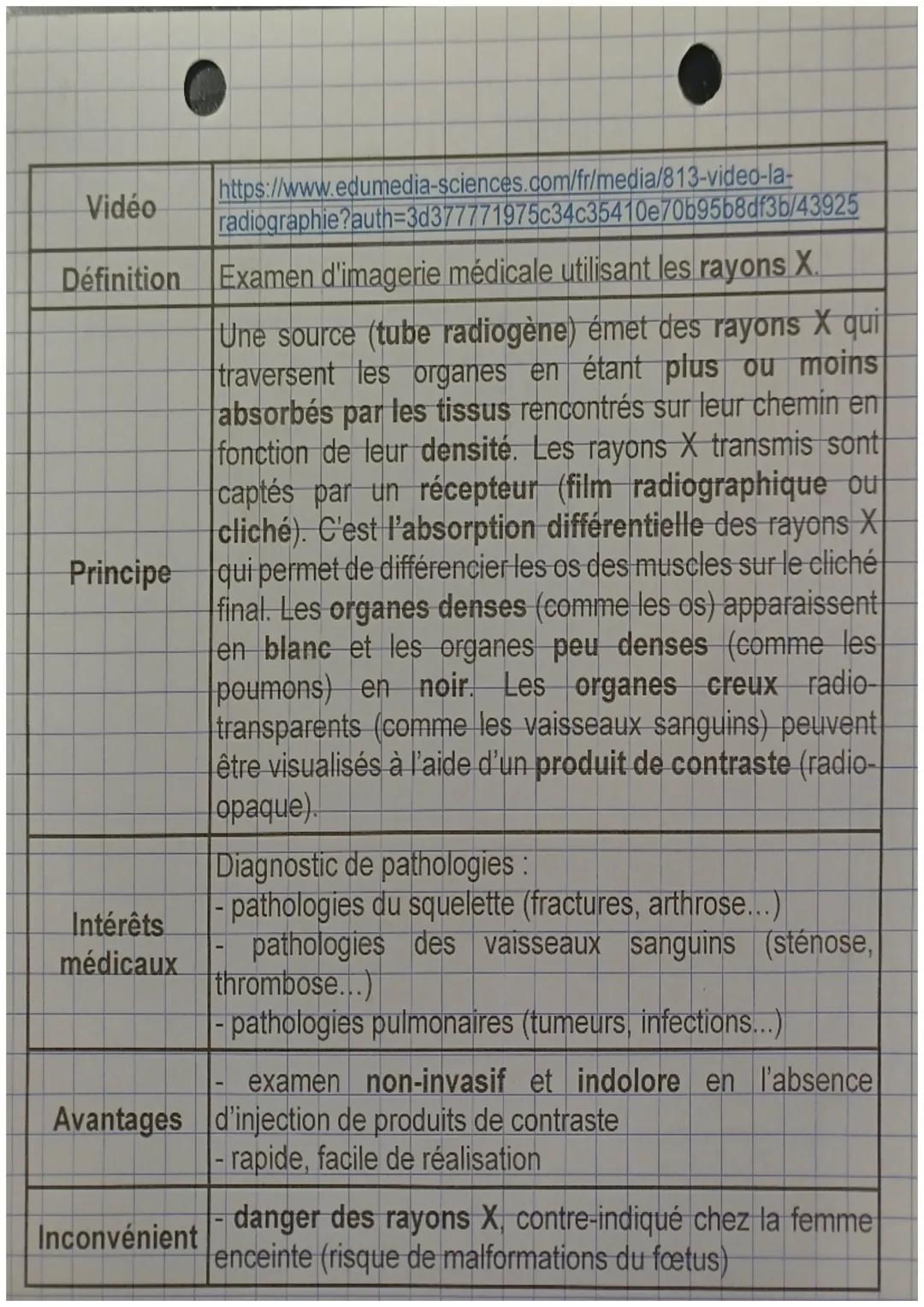 Radiographie

La radiographie

Fiin photosensible
pu plaque numérique

Tube à rayon X

Manchon
haute tension

Gaine plompée

۱۵

Anode

Cano