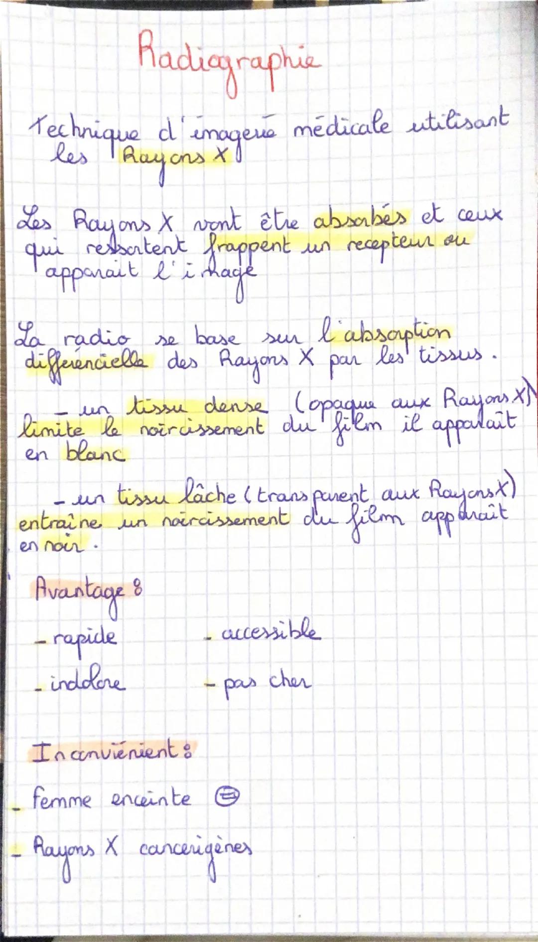 # Radiographie

Technique d'imagevé médicale utilisant
les Rayons X

Les Rayons X vont être absabés et ceux
qui ressortent frappent un recep