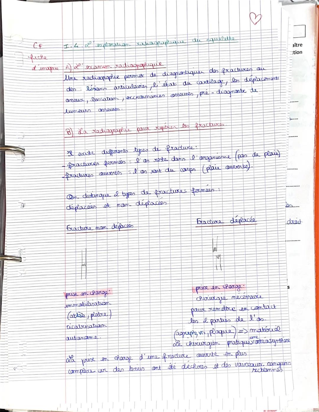 
<p>Une radiographie permet de diagnostiquer des fractures ou des lésions articulaires, l'état du cartilage, les déplacements, les luxations