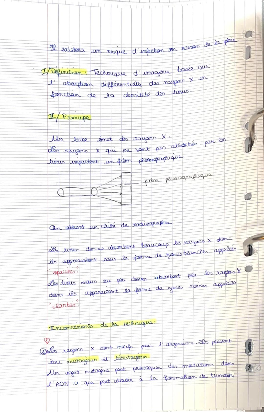 
<p>Une radiographie permet de diagnostiquer des fractures ou des lésions articulaires, l'état du cartilage, les déplacements, les luxations