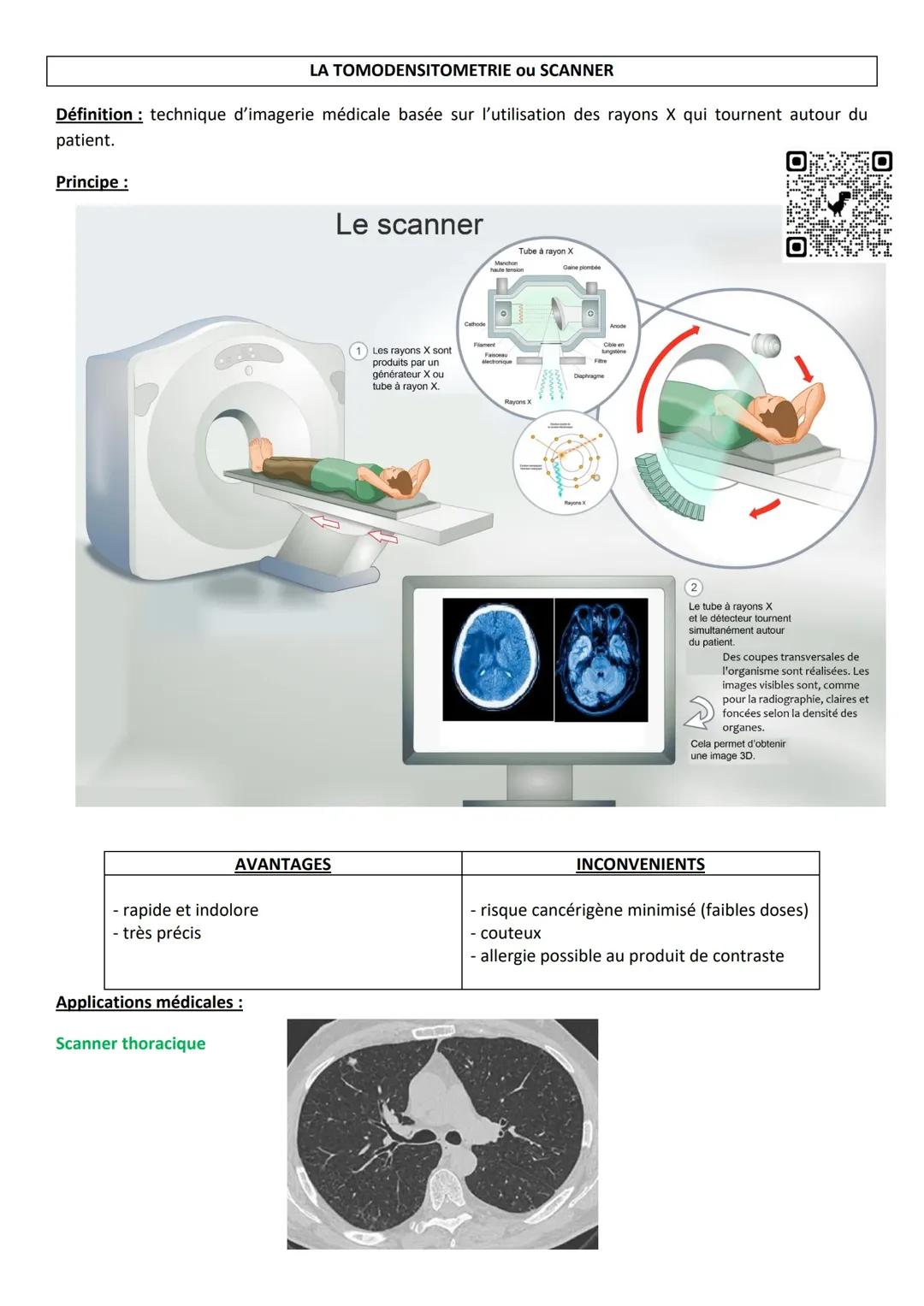 Le scanner (imagerie médicale) 