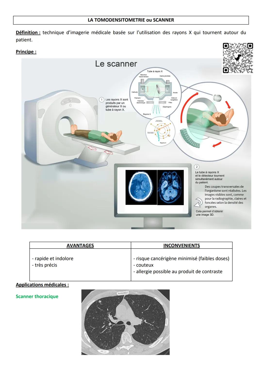 LA TOMODENSITOMETRIE ou SCANNER
Définition technique d'imagerie médicale basée sur l'utilisation des rayons X qui tournent autour du
patient