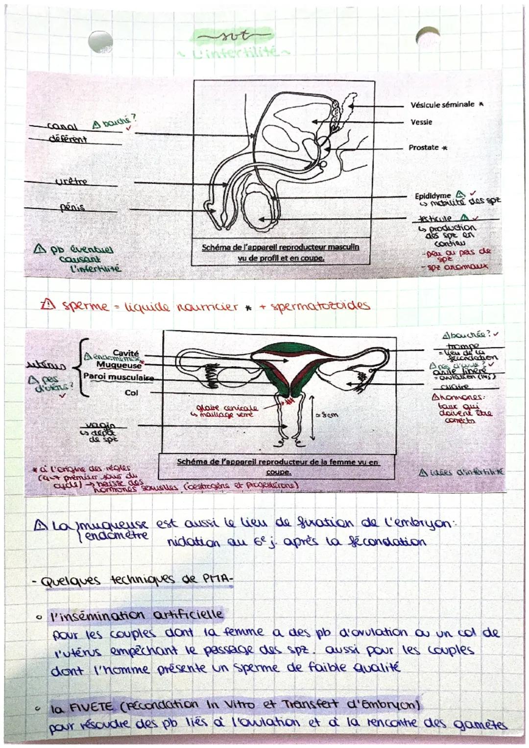 conal
déférent

A bouché?

Uretre

pénis

A pb éventuel
causant
L'infertilite

sot
Linfertilite

Vésicule séminale A

Vessie

Prostate *


S