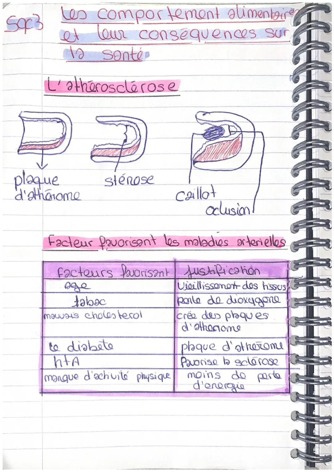 Soc3 les comportement alimentaire
et leur consequences sur
la santé

L'atherosclerose


plaque
d'thorome
stérose

Caillat
oclusion

Facteur 
