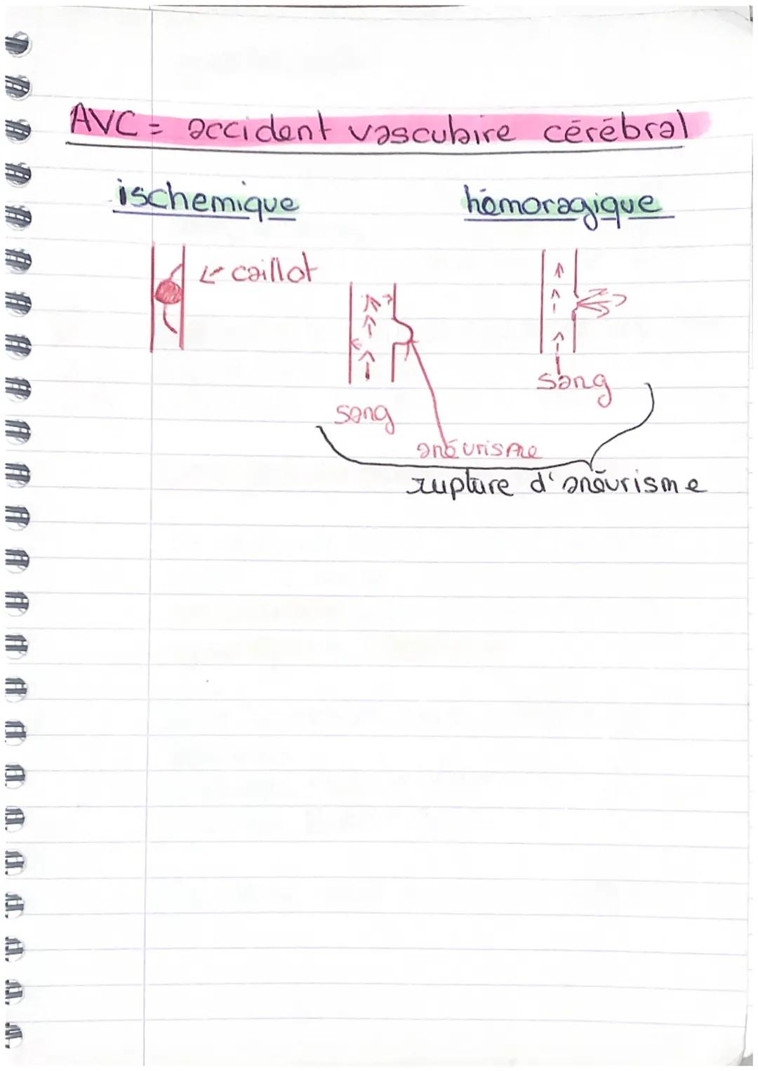 Soc3 les comportement alimentaire
et leur consequences sur
la santé

L'atherosclerose


plaque
d'thorome
stérose

Caillat
oclusion

Facteur 