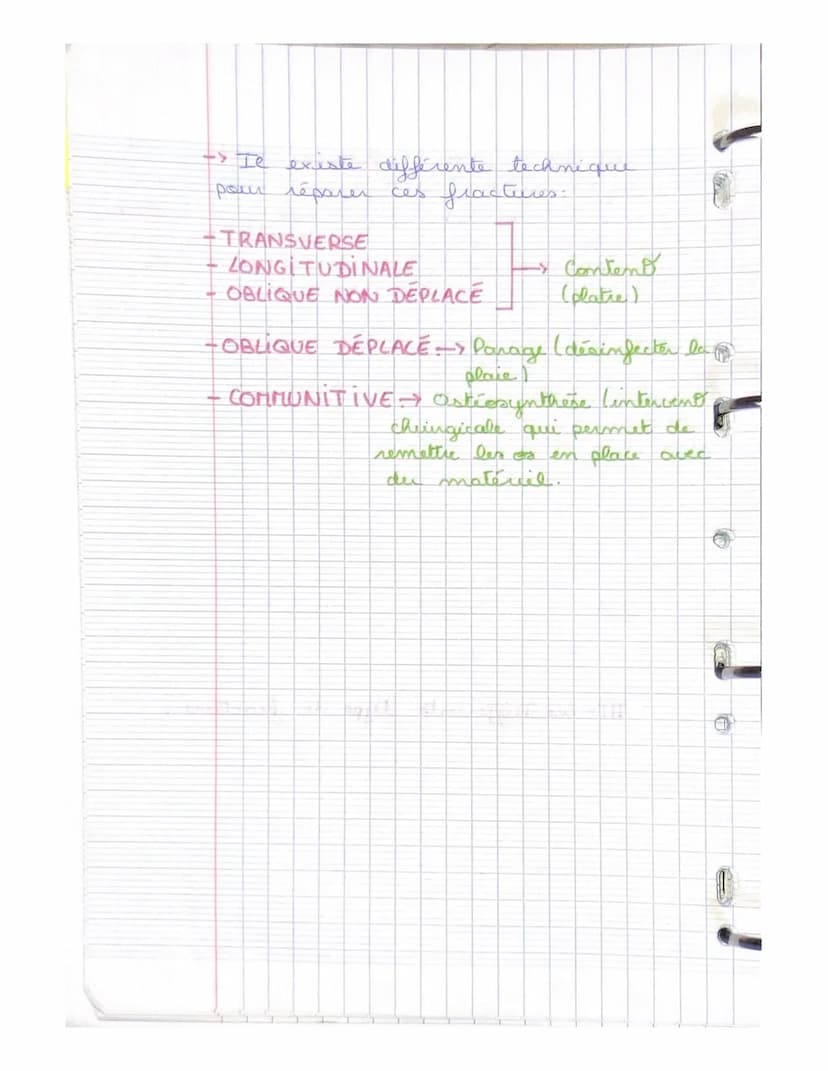LE SYSTEME SQUELETTIQUE
(LE SQUELETTE)
LE SQUELETTE: il se compose d'os,
d'articulat, de ligaments, de tendons
et de cartilage. Charpente du