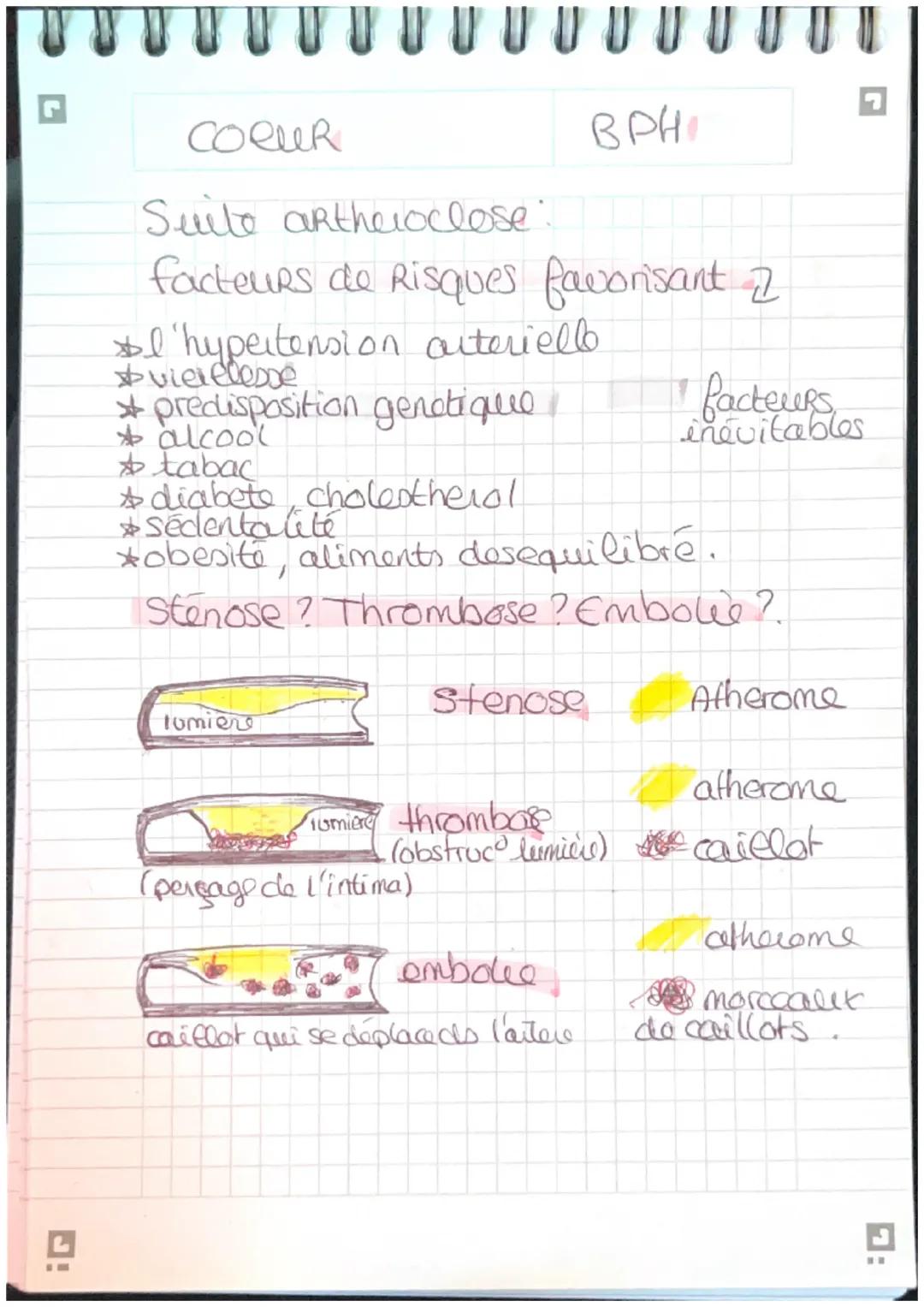 G

COCUR

BPH

Schema myocarde,

Sang riche en O2
Sang pauvre en 02

Artere corte

veine cave superieur

veine pulmo d

artère pulmonare

ve