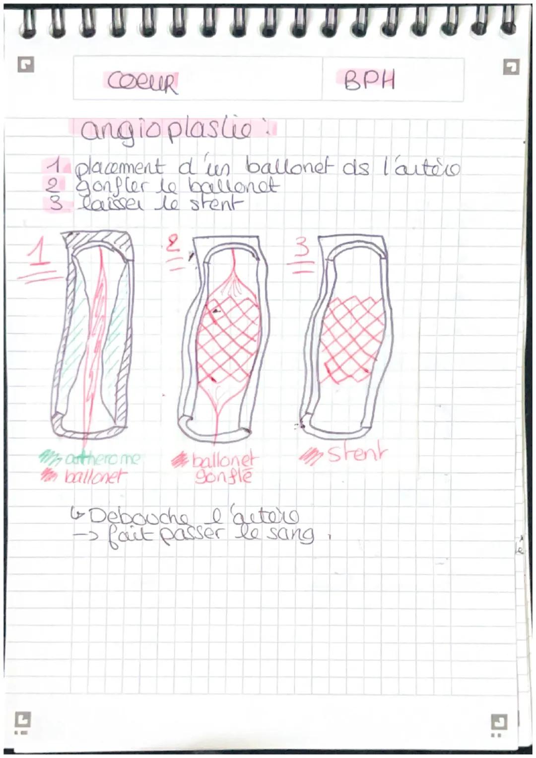 G

COCUR

BPH

Schema myocarde,

Sang riche en O2
Sang pauvre en 02

Artere corte

veine cave superieur

veine pulmo d

artère pulmonare

ve