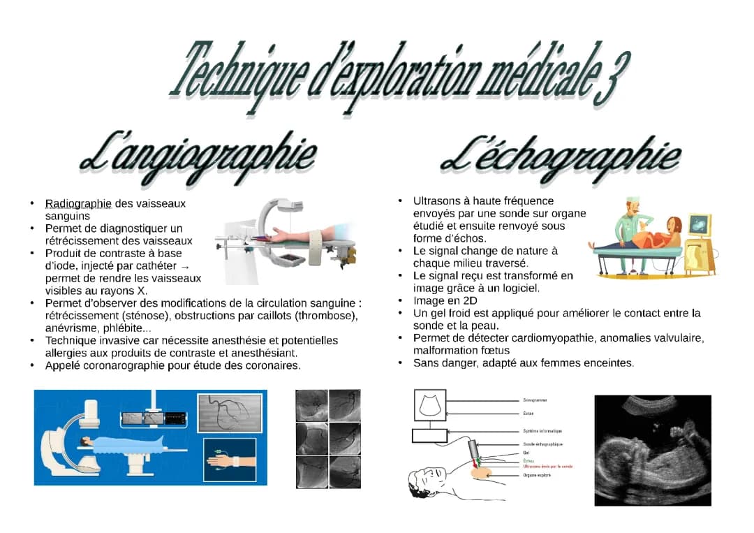 Fiche ST2S BPH : L'angiographie et l'échographie 