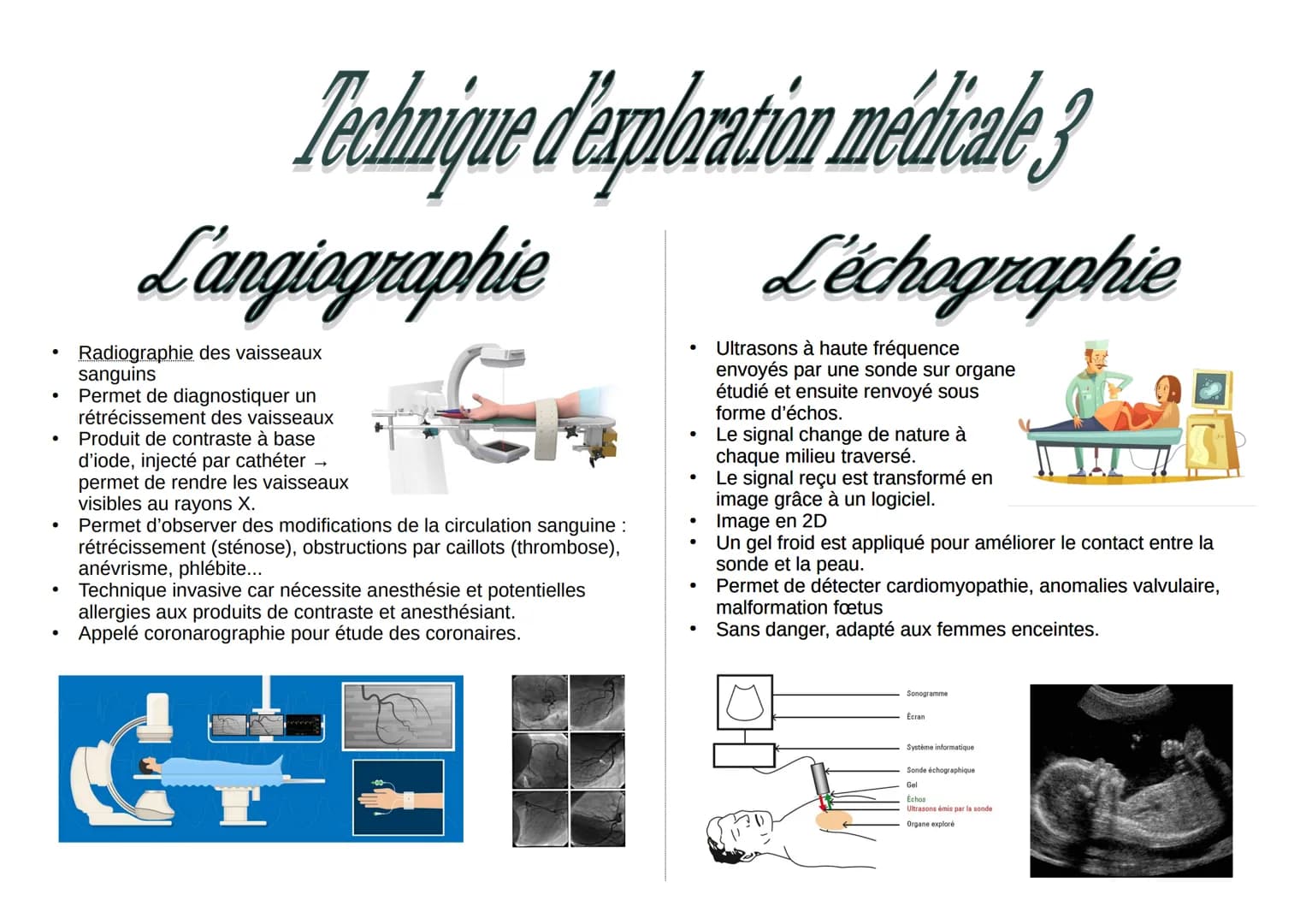 Technique d'exploration médicale 3
L'angiographie
L'échographie
Radiographie des vaisseaux
sanguins
Permet diagnostiquer un
rétrécissement d
