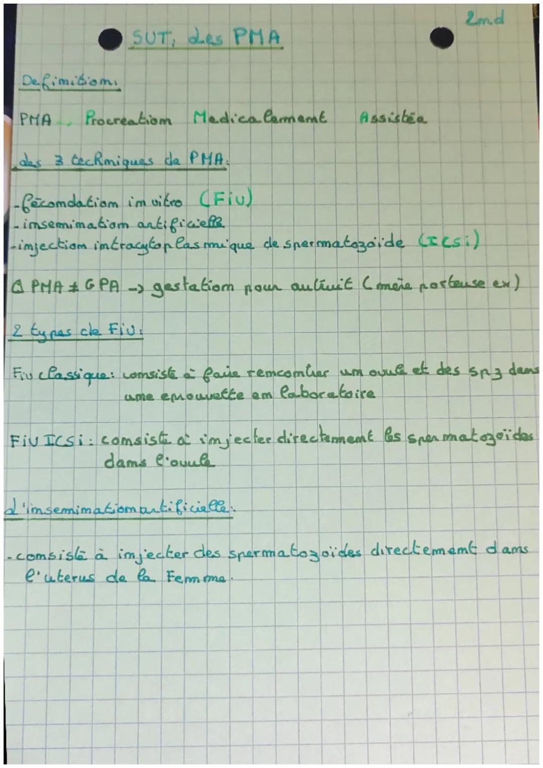 Definition
PMA
SUT, Les PMA
Procreation Medica Comment
Assistéa
2m.d
ales 3 techmiques de PMA.
-fécondation in vitro (Fiu)
-imsemimation art