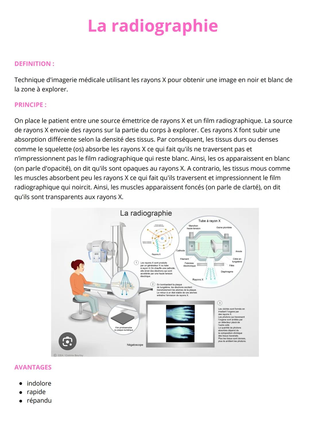 # La radiographie
DEFINITION:
Technique d'imagerie médicale utilisant les rayons X pour obtenir une image en noir et blanc de
la zone à ex
