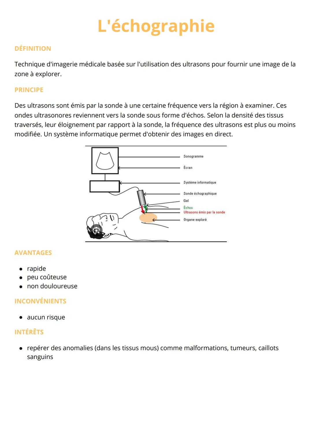 # L'échographie
DÉFINITION
Technique d'imagerie médicale basée sur l'utilisation des ultrasons pour fournir une image de la
zone à explore